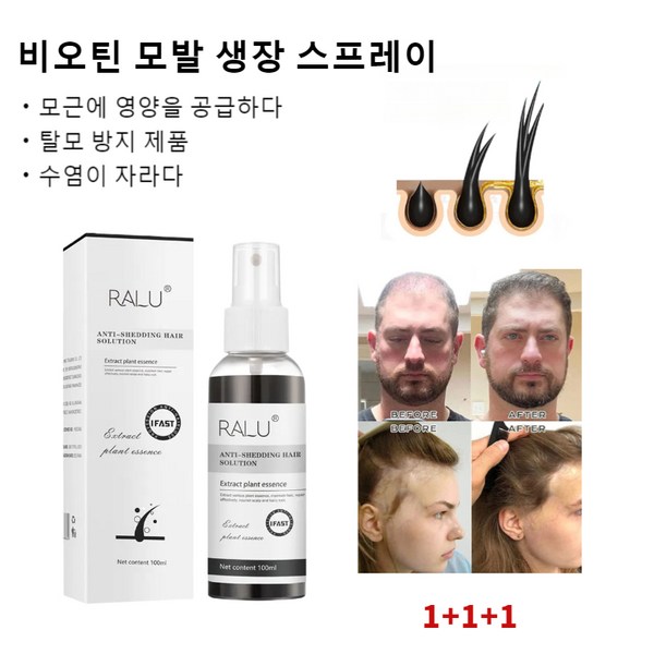 증진 모낭 성장 스프레이 모발 영양제 탈모증상완화