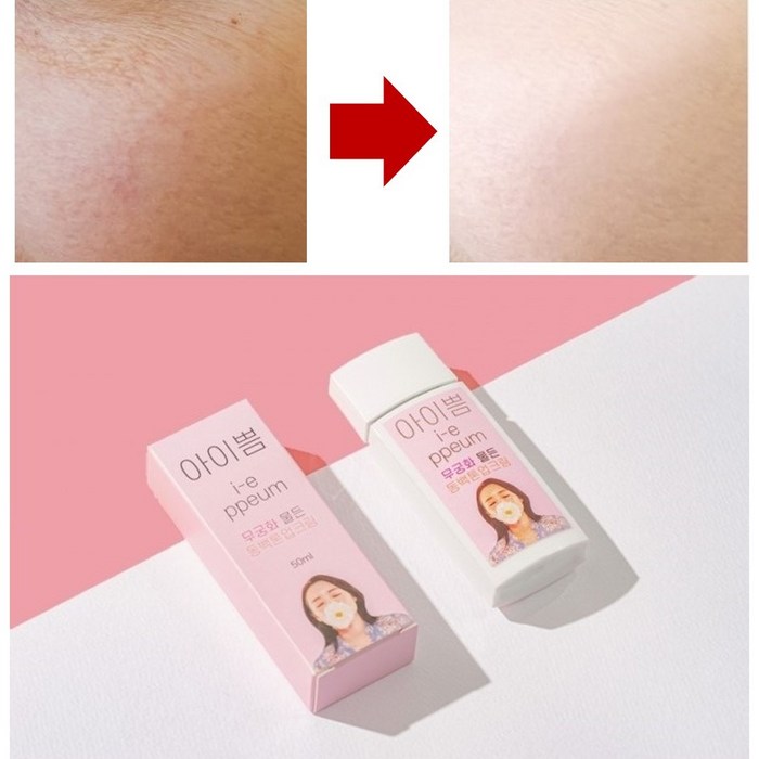 유두 미백 엉덩이 색소침착 크림 저자극 화이트닝 톤업크림 얼굴 피부 하얘지는 크림 화장품 대표 이미지 - 유두 미백크림 추천