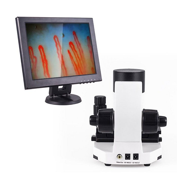 저렴한 가격 공장 공급 업체 lcd 12 인치 600x microcirculation 검사 현미경, 미국 플러그^0