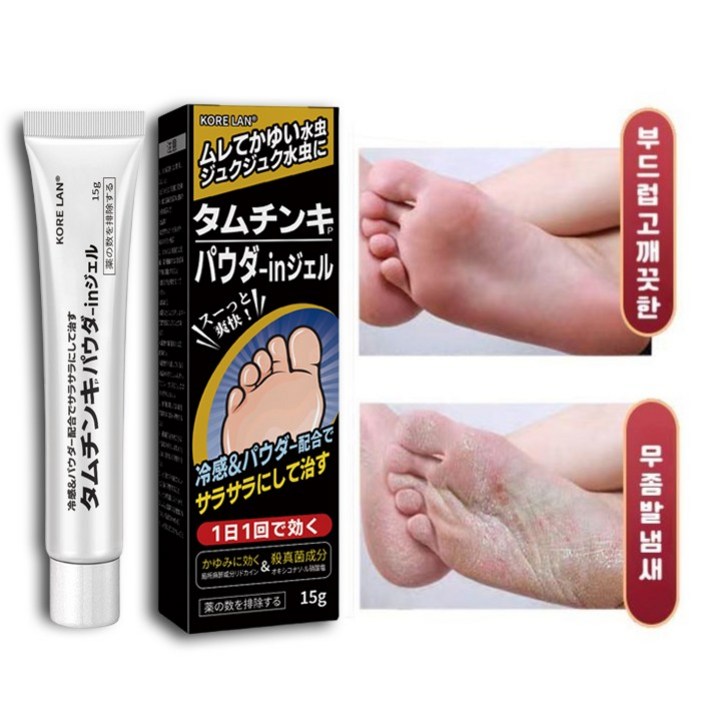 [당일배송] ANLAIHUI 발치료 가려움 악성체취 발냄새 발각질 완화 가려움 방지 살균 발 탈피 억제 연고