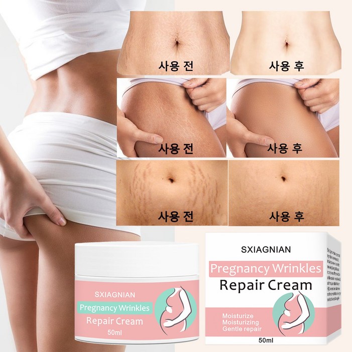 한국셀러본토출하임산부 산전후 튼살 탄력케어 크림 흉터관리 임산부 청소년 이용가능, 2개, 50g 한국셀러본토출하임산부 산전후 튼살 탄력케어 크림 흉터관리 임산부 청소년 이용가능, 2개, 50g
