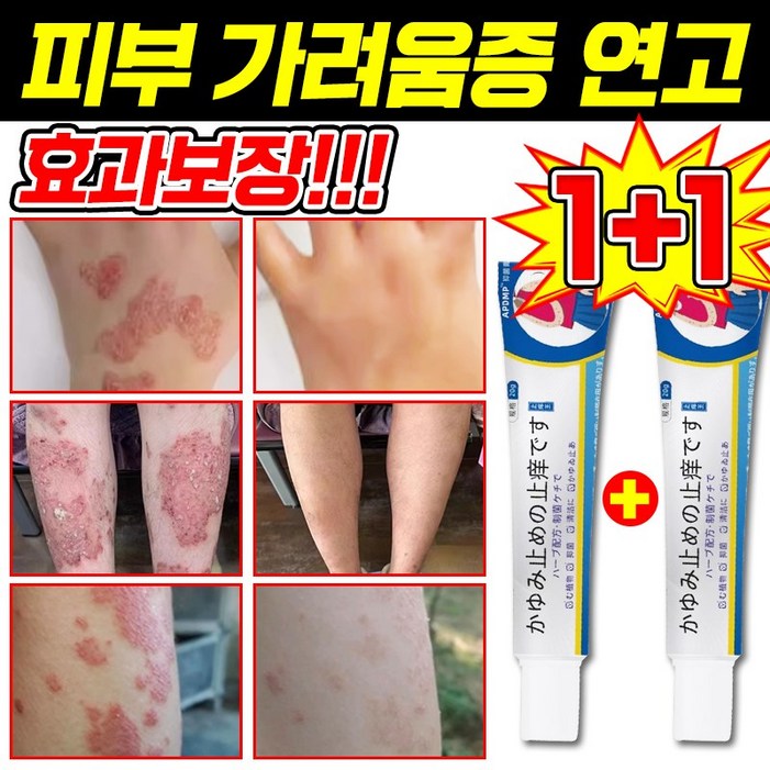 일본 기술 피부 가려움증 연고 건선 연고 습진 치료제 모낭염 연고 지루성 피부염 각종 피부 트러블 곰팡이균 볽은반점 완화 크림