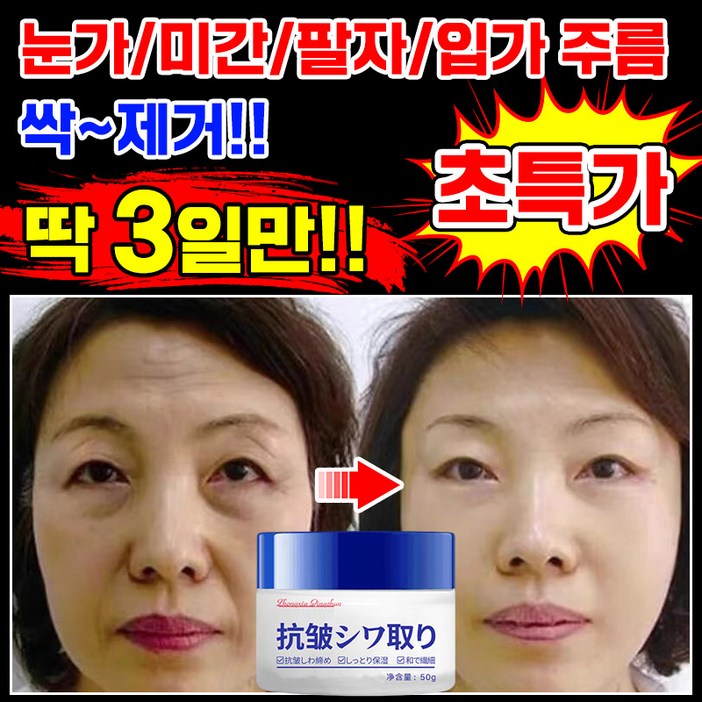 [100% 제거] 일본 1/1+1/2+2 주름개선 크림 재생크림 눈가 미간 팔자 주름 제거 크림 레티놀 탄력 미백 수분크림 리프팅 모공 수축