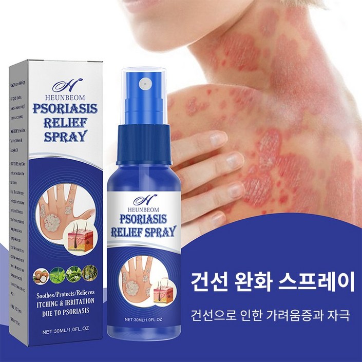 건선 피부건선 건선 연고 피부건선증상 건선 연고 건선 스프레이 건선 피부건선 건선 연고 피부건선증상 건선 연고 건선 스프레이