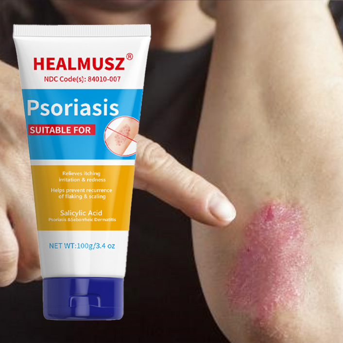 HEALMUSZ 건선 연고 땀포진, 건선 습진 등 피부 가려움 완화, 100ml, 2개