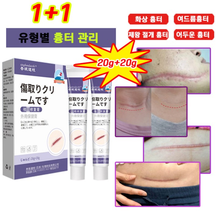 [100%제거/당일배송]  흉터제거연고 상처흉터연고 여드름 연고 민감한 피부를 수술 화상 제왕절개 수술흉터 연고