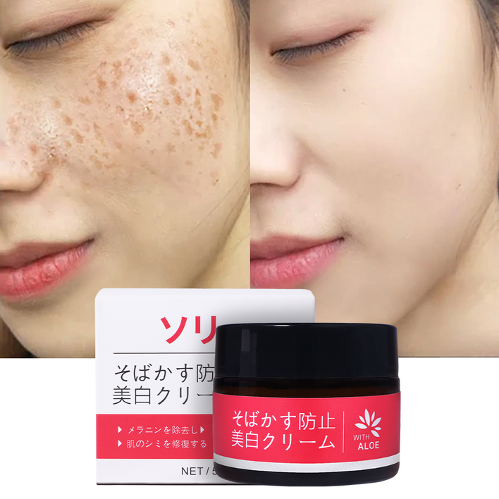 일본 기미크림 멜라노사 크림 미백 기능성 크림 기미 잡티 검버섯 얼굴 색소침착 개선 피부 화이트닝 톤업 기미 잡티 제거 크림1위, 50g, 1개