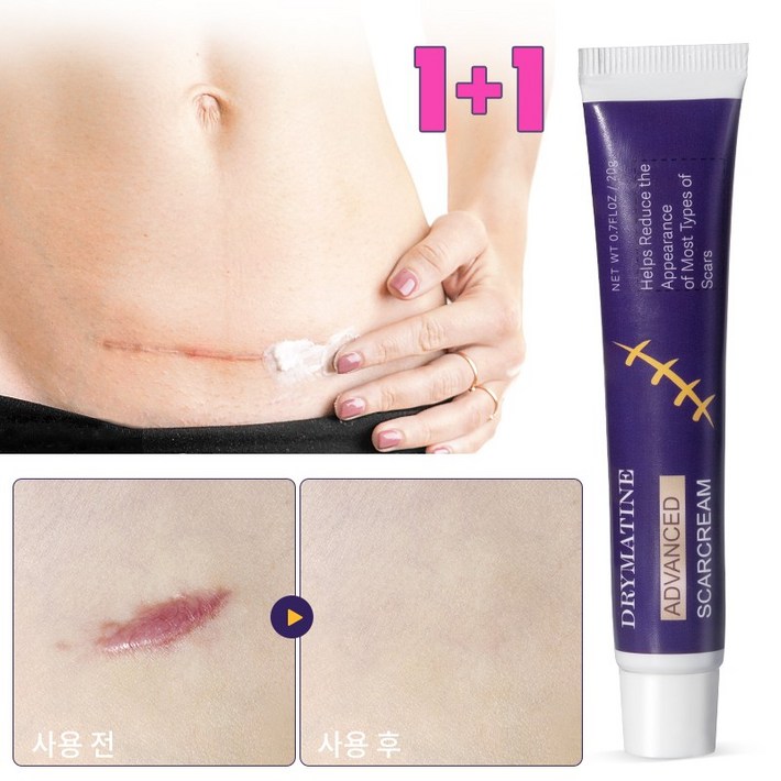 당일배송 DRYMATINE 흉터연고 흉터제거연고 재생크림 상처흉터연고 여드름흉터 수술흉터 화상물집 흉터제거연고 당일배송 DRYMATINE 흉터연고 흉터제거연고 재생크림 상처흉터연고 여드름흉터 수술흉터 화상물집 흉터제거연고