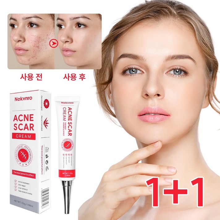 재생크림 여드름리페어연고 색소침착 여드름흉터 수술흉터 피지케어크림 재생크림 여드름리페어연고 색소침착 여드름흉터 수술흉터 피지케어크림