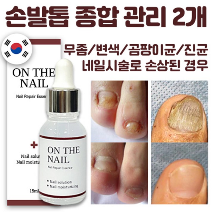 명품 온더네일 에센스 네일 트리트먼트 손발톱 강화 곰팡이균 무좀 변색 젤네일시술로 인한 손톱 발톱 손상 리페어 에센스 nail repair nail fungus treatment, 15ml, 2개