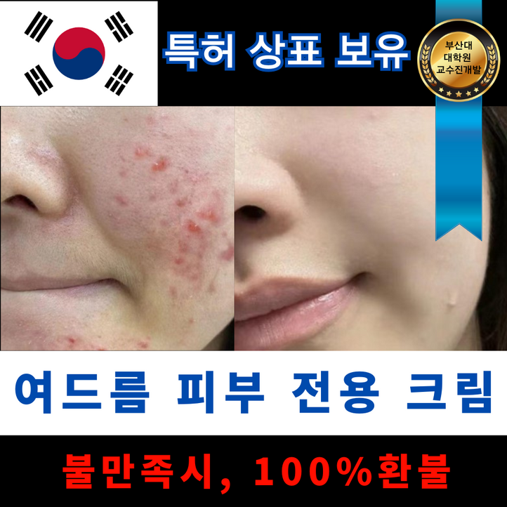 아줄랩 청소년 여드름 화장품 흉터 재생크림