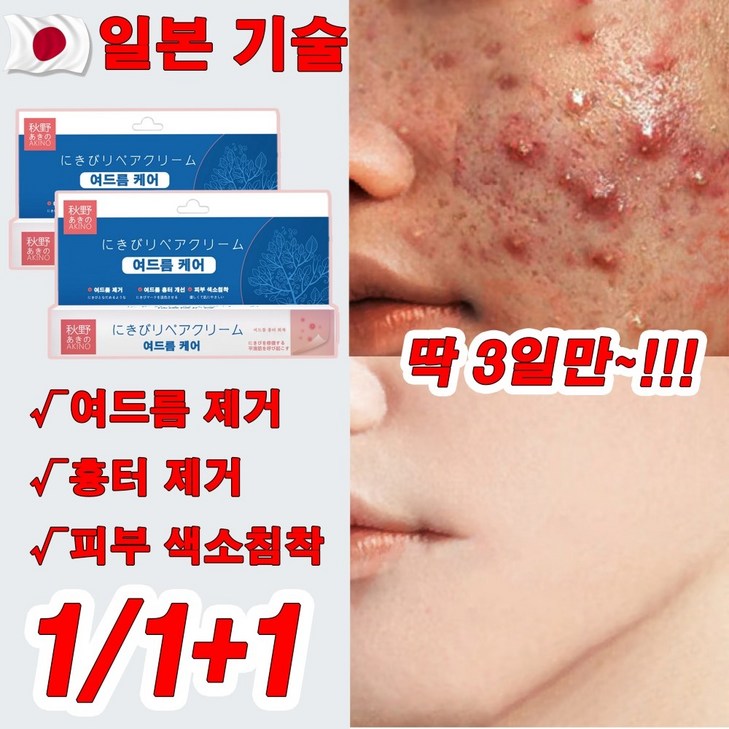 일본 111 자생크림 여드름 크림 여드름 흉터 제거 연고 여드름 케어 색소침착 선물 랜덤 증정