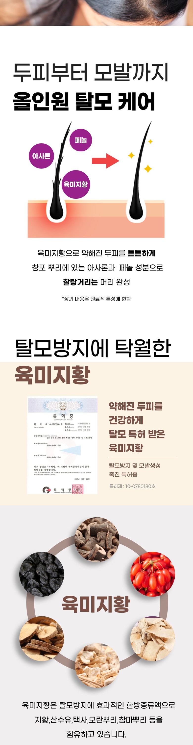 두피 각질의 원인을 발견했네. 5